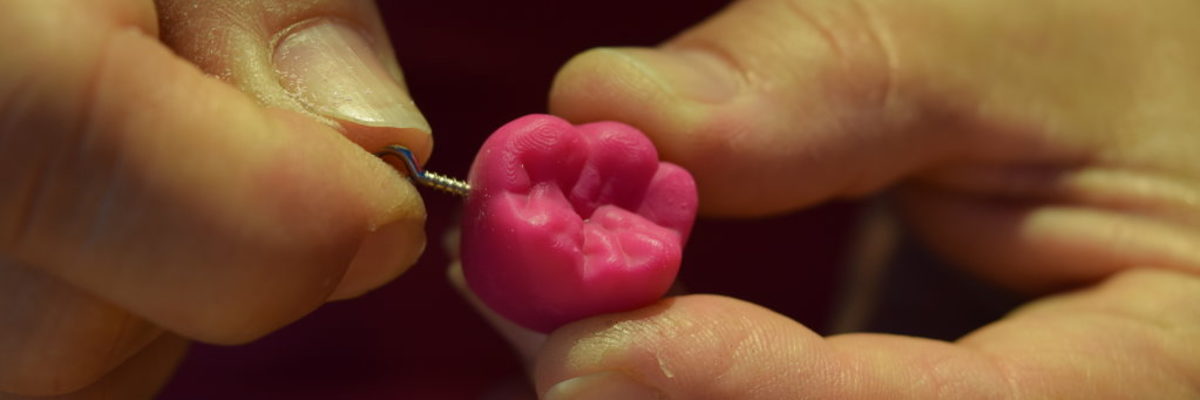 Zahntechnik selbst ausprobieren, hier am 3D-Zahn als Schlüsselanhänger. zwei Hände halten frisch aus dem 3D-Drucker gedruckten, pinken Zahn in der Hand, eingeschraubt wird ein Schlüsselanhänger